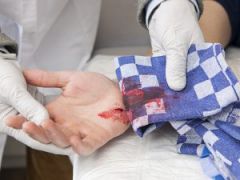رؤية الدم في المنام يخرج من شخص آخر