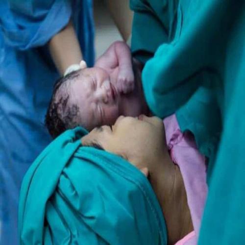 حلم الولادة القيصرية - تفسير الاحلام اون لاين