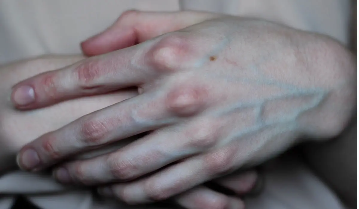 Interpretació dels somnis de les venes de la mà
