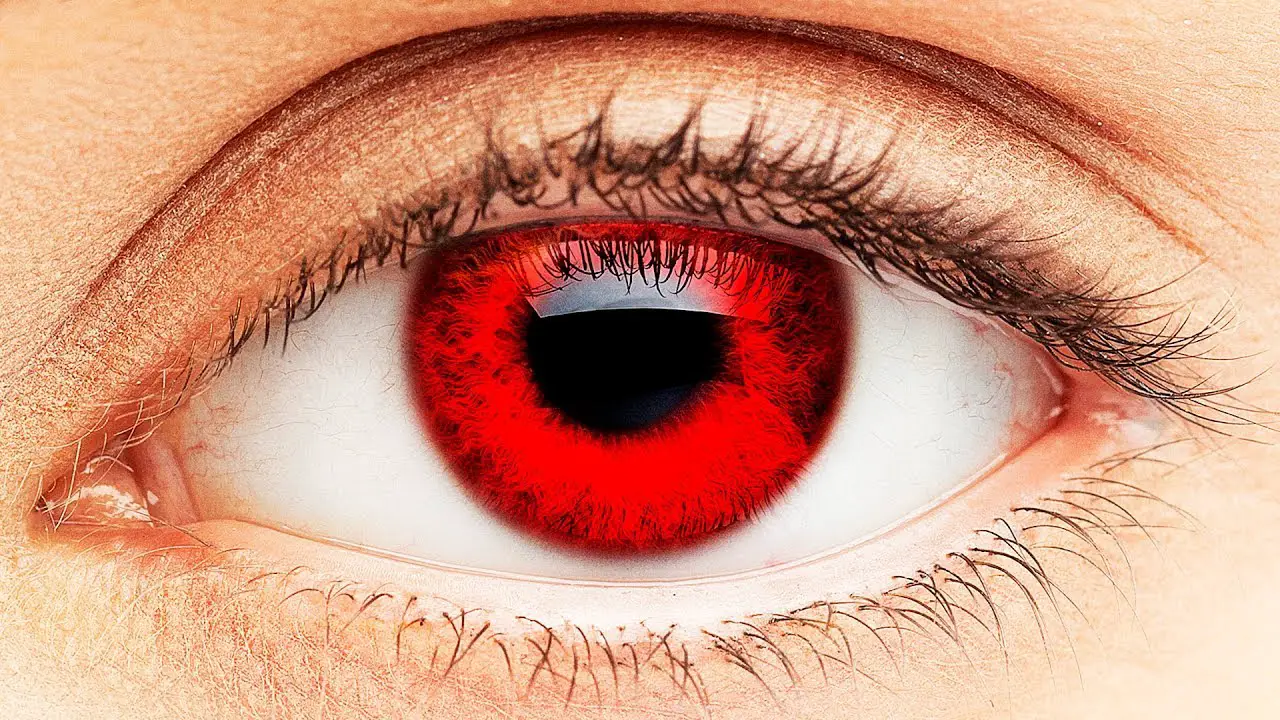 العين حمراء في المنام - تفسير الاحلام اون لاين