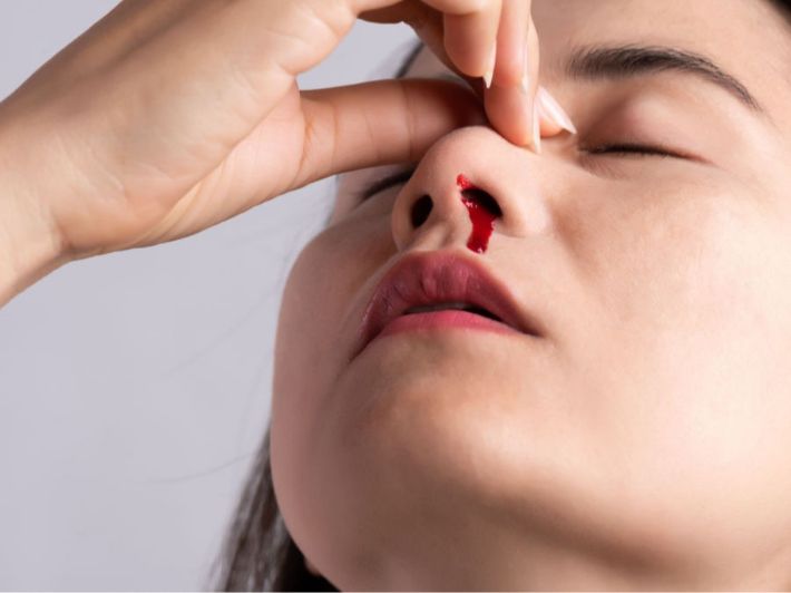 सिरदर्द के साथ नाक से खून आना - सपनों की ऑनलाइन व्याख्या