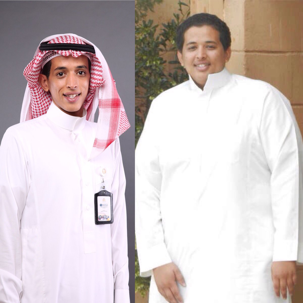 تجربتي مع تكميم