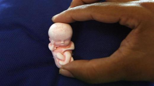 Fortolkning af Jeg drømte, at jeg havde en abort og så fosteret, mens jeg ikke var gravid i en drøm ifølge Ibn Sirin