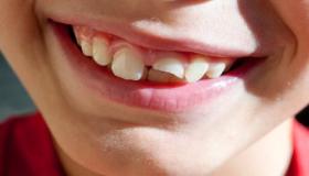 इब्न सिरिन के दांत तोड़ने के सपने की व्याख्या क्या है?