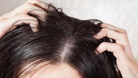 Ո՞րն է Իբն Սիրինի համաձայն ամուսնացած կնոջ մազերի ոջիլների մասին երազի մեկնաբանությունը: