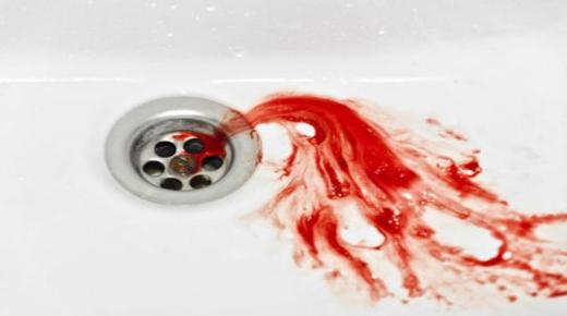 Els 20 signes més importants de veure vomitar sang en un somni