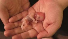 इब्न सिरिन द्वारा एक सपने में गर्भपात की सबसे महत्वपूर्ण 10 व्याख्याएँ