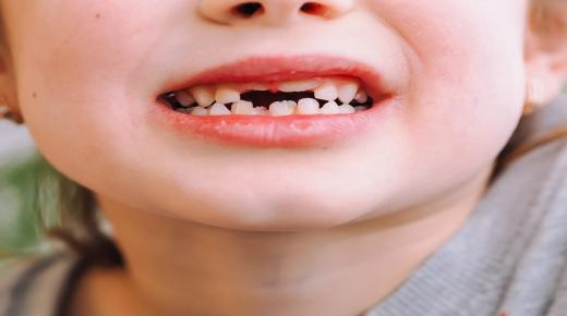 ما هو تفسير رؤيه وقوع الاسنان في المنام لابن سيرين؟