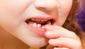 ما هو تفسير حلم سقوط الاسنان السفلية في المنام لابن سيرين؟