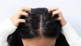 Les 100 interpretacions més importants de veure com es retira el cabell en un somni a una dona soltera, segons Ibn Sirin