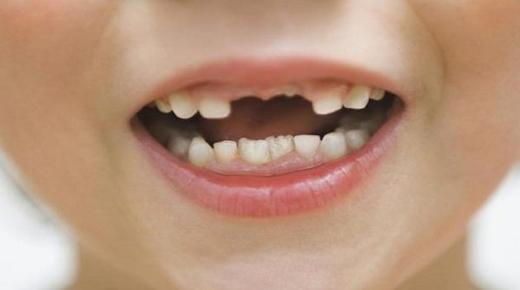 ما هو تفسير حلم رؤية الاسنان تتساقط لابن سيرين؟